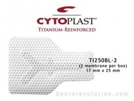Ti-250 Buccal (2 membranes per box)