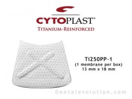 Ti-250 Posterior Perio (1 membrane per box)